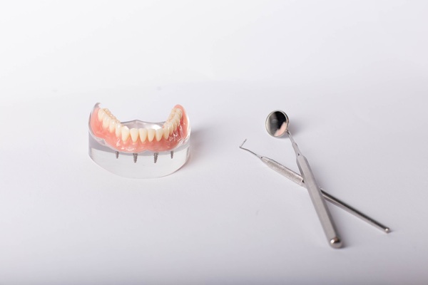When To Consider Implant Supported Dentures Over Traditional Dentures